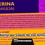 Hay casi 2.000 casos de tos ferina en Wisconsin